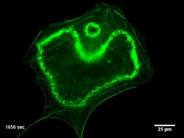 Actin Riched Circular Dorsal Ruffles Upon PDGF Stimulation