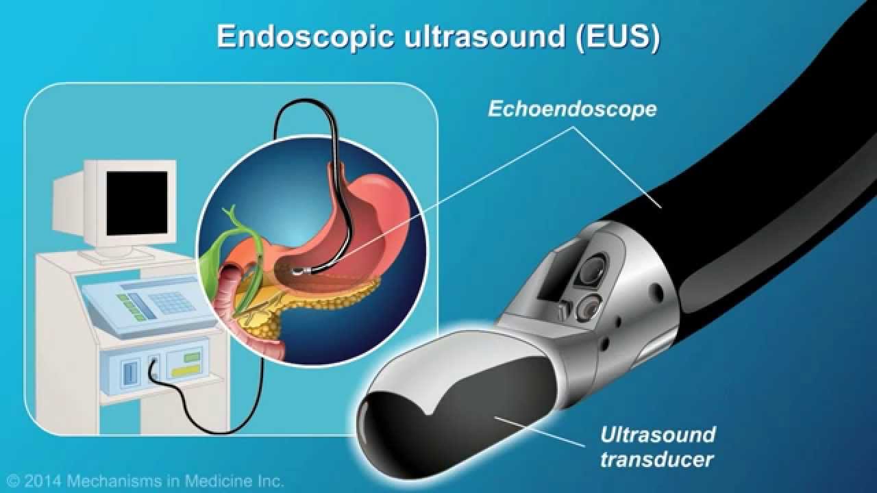 Animation Understanding Eus Fna