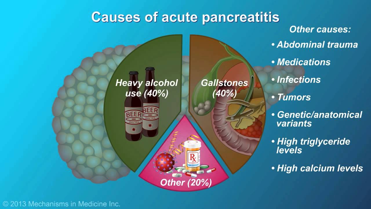 Animation - Acute Pancreatitis < Yale School of Medicine