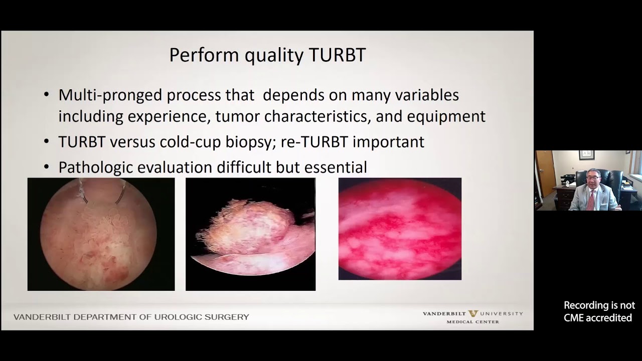 Optimizing Bladder Cancer Treatment During the BCG Shortage Era